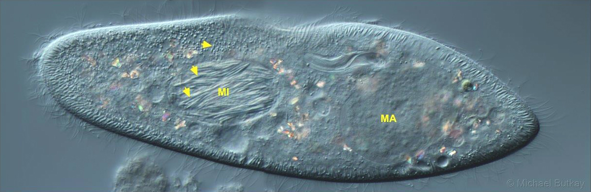 Paramecium_caudatum_Holospora