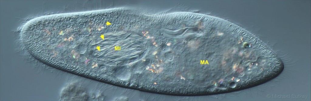 Paramecium_caudatum_Holospora