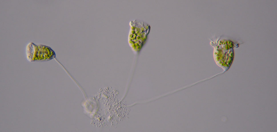 Vorticella chlorellata